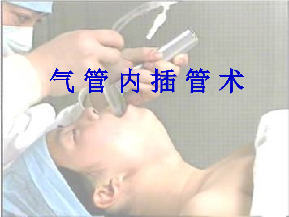 气管插管术课件.ppt_第1页