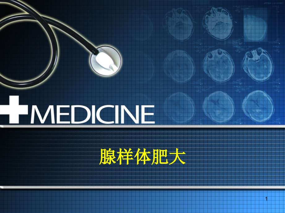 腺样体肥大课件.ppt_第1页