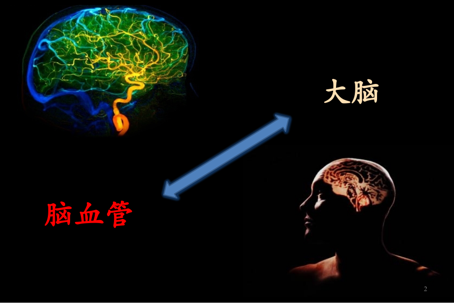 缺血性脑卒中的治疗与预防.pptx_第2页