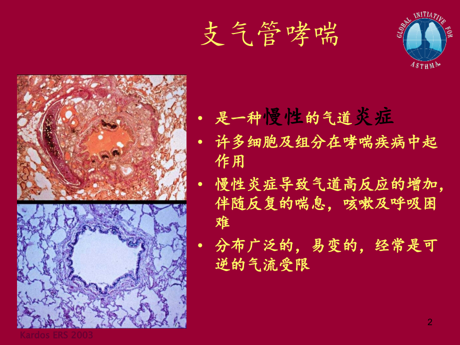 哮喘治疗策略.ppt_第2页