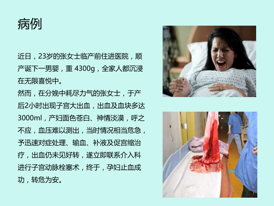 产后出血教学版优质课件.ppt_第1页