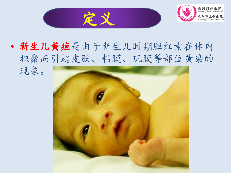 新生儿黄疸护理课件.pptx_第2页