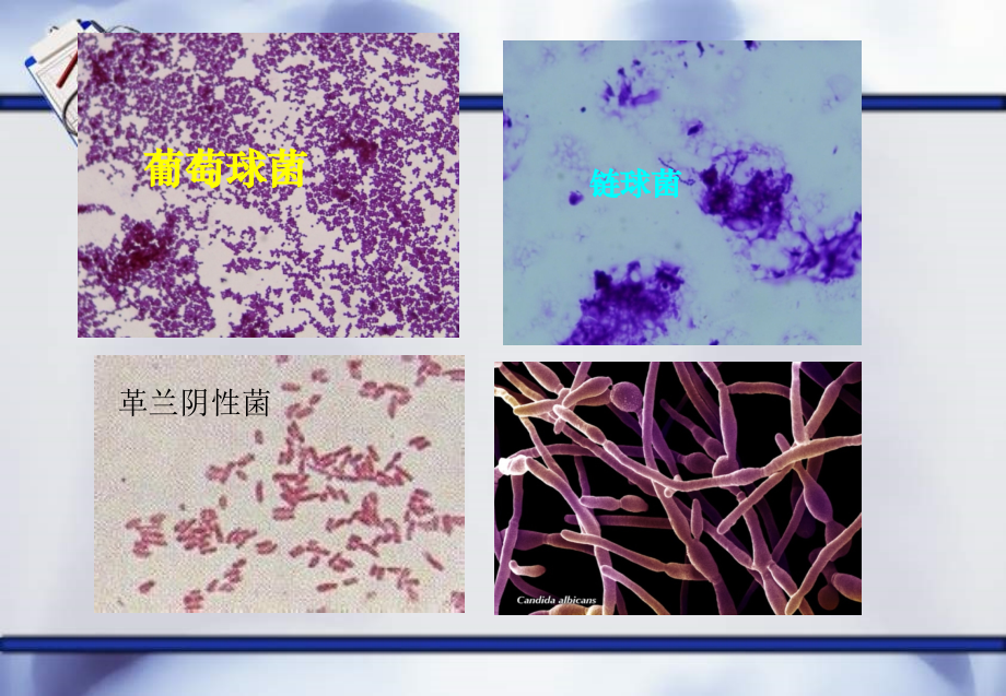 抗生素的合理使用课件.ppt_第2页