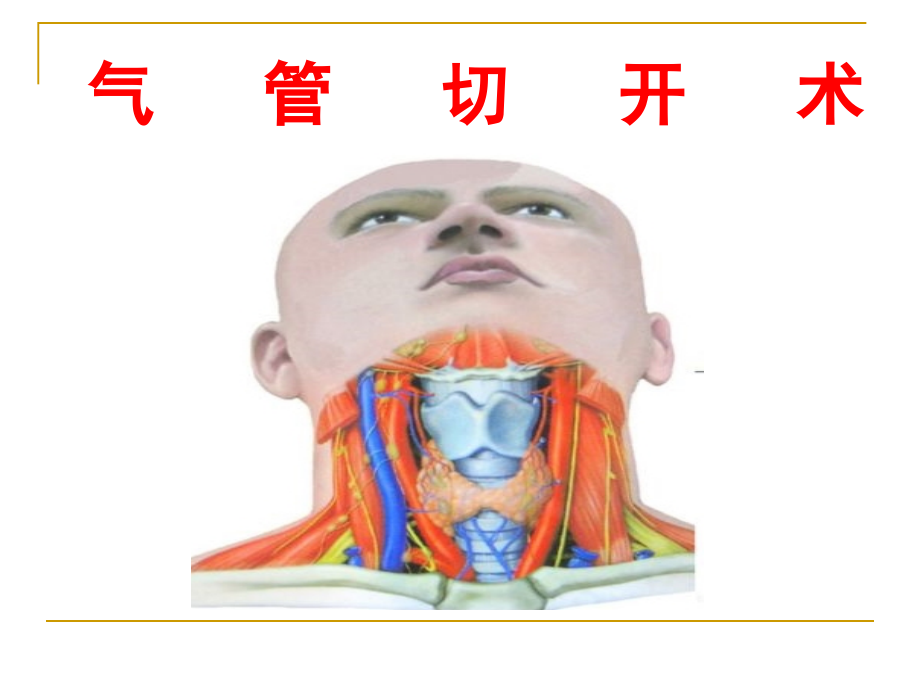 气管切开课件.ppt_第1页