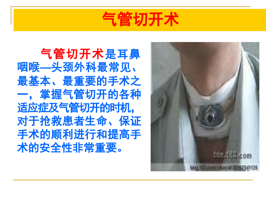气管切开课件.ppt_第2页