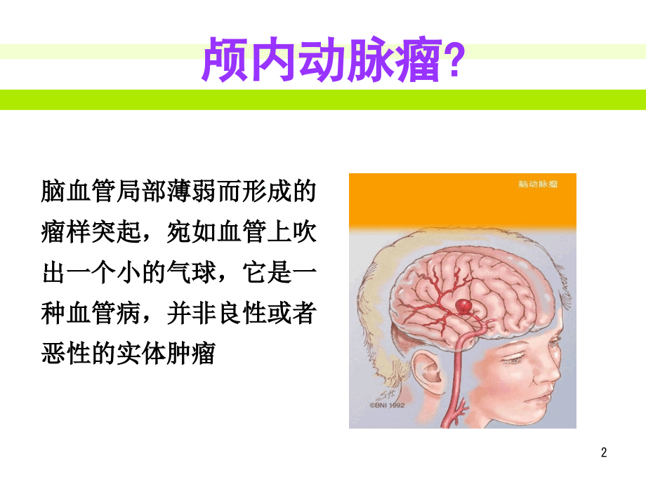 一列动脉瘤患者的护理查房.ppt_第2页
