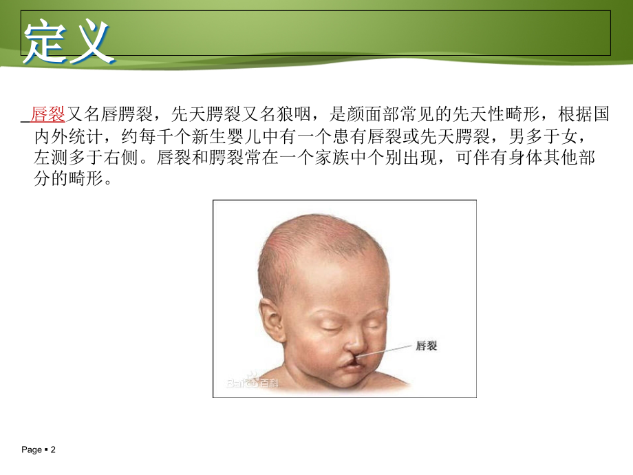唇腭裂ppt医学课件.ppt_第2页