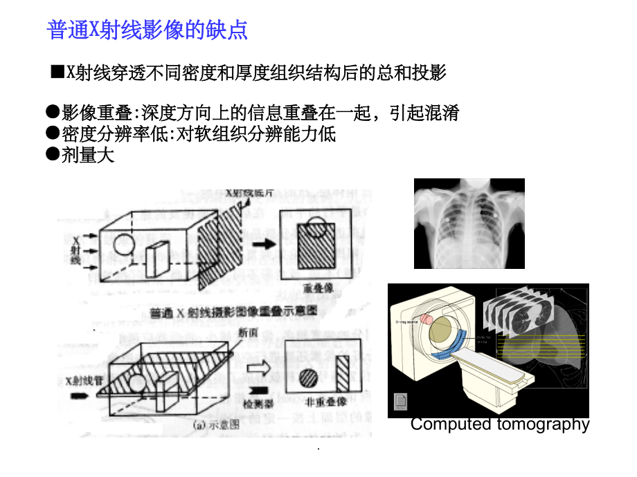 X-CT成像原理.ppt_第2页