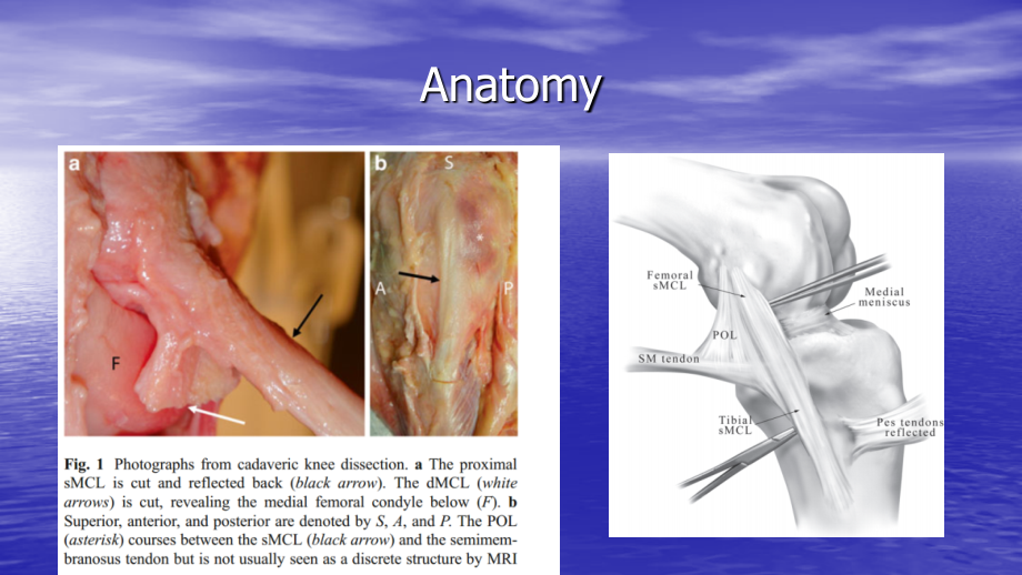 内侧副韧带解剖治疗方案的选择ppt医学课件.pptx_第2页