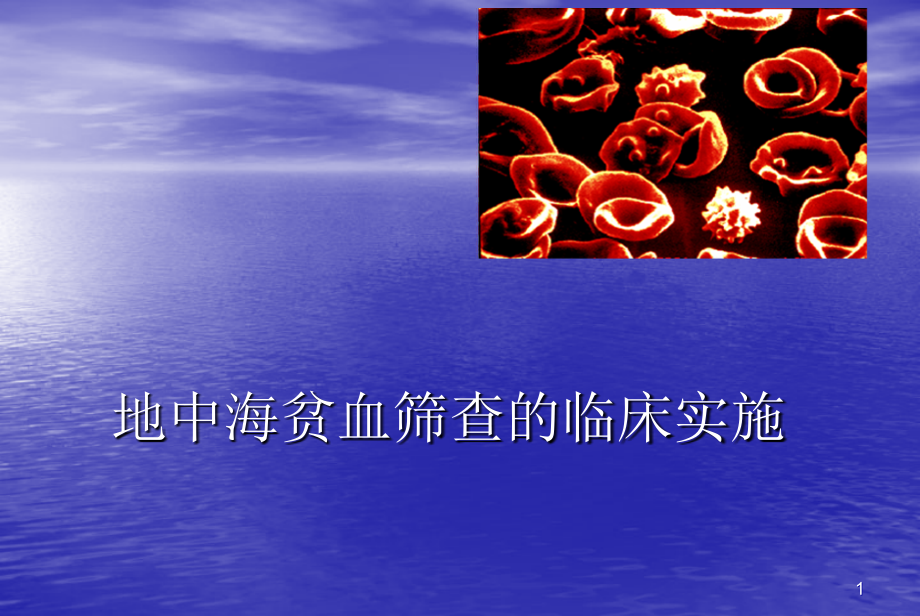 地中海贫血筛查.ppt_第1页