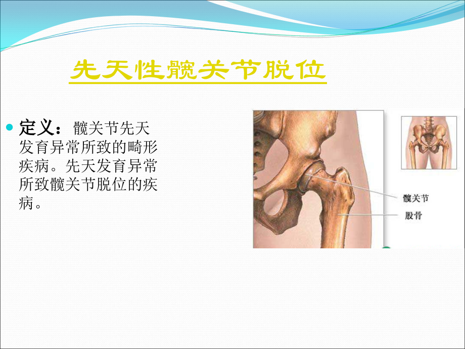 小儿骨病演示文稿.ppt_第2页