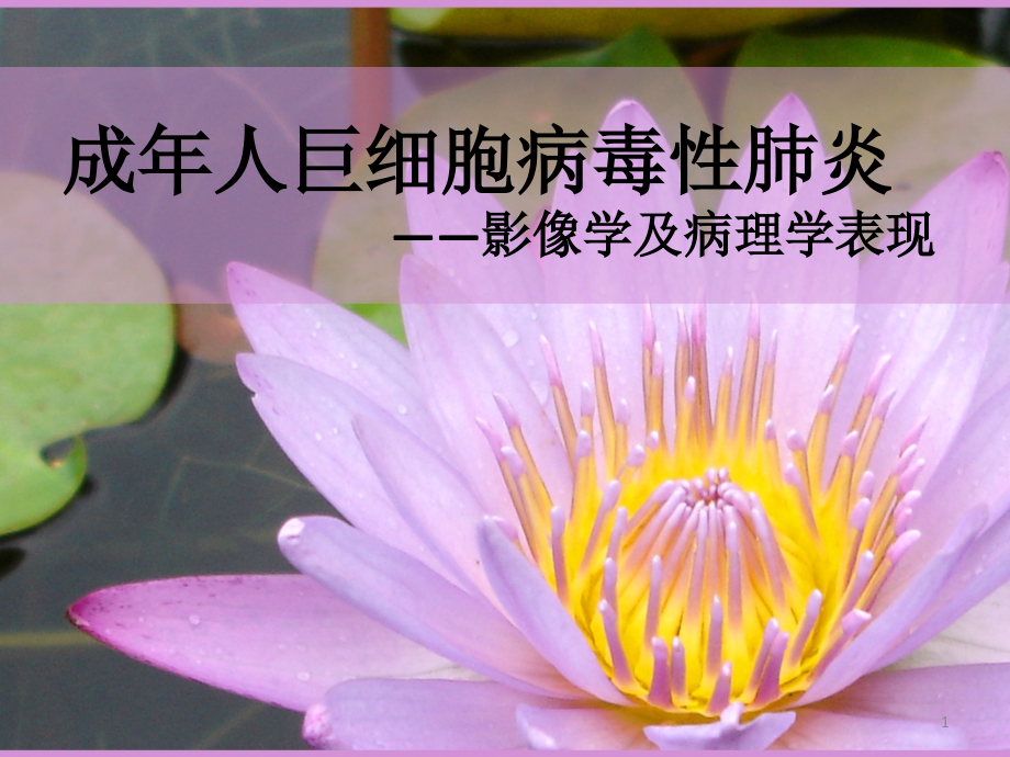 成年人巨细胞病毒性肺炎.ppt_第1页