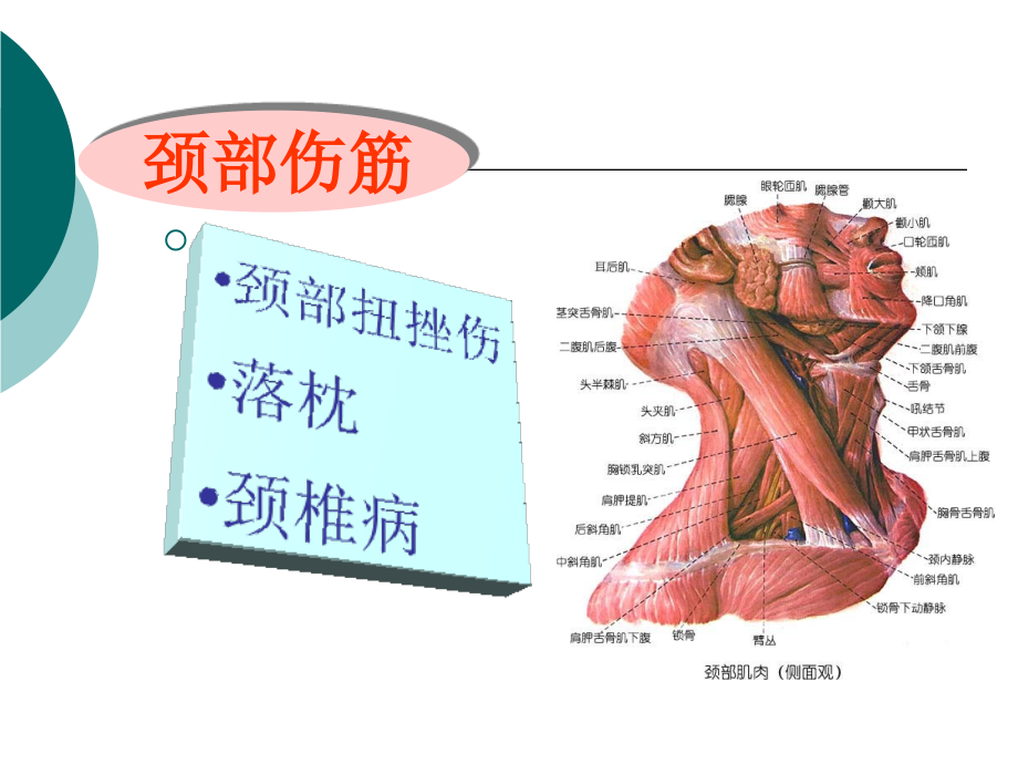 颈部筋伤详解PPT课件.ppt_第2页