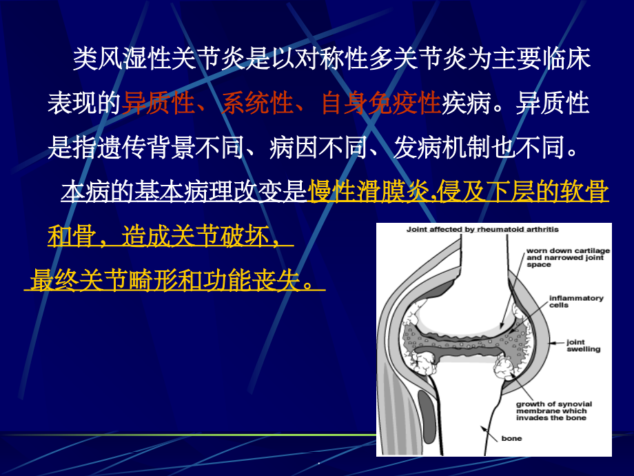 内科学整理类风湿性关节炎.ppt_第2页