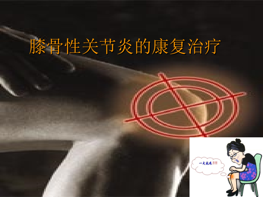 关节炎康复.ppt_第1页