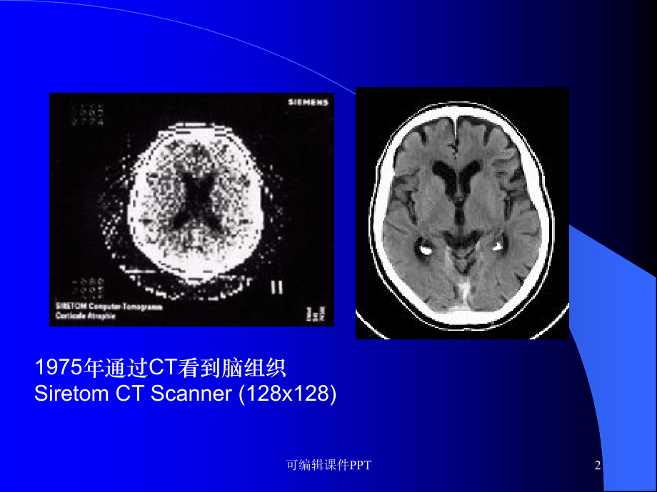 头颅CT课件.ppt_第2页