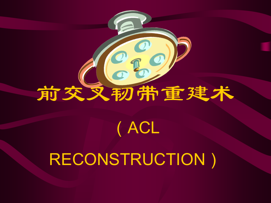 ACL重建术.ppt_第1页