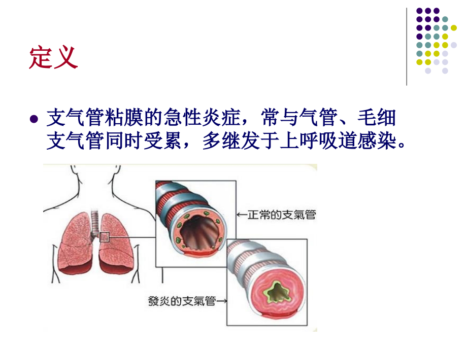 儿科急性支气管炎的教案设计.ppt_第2页