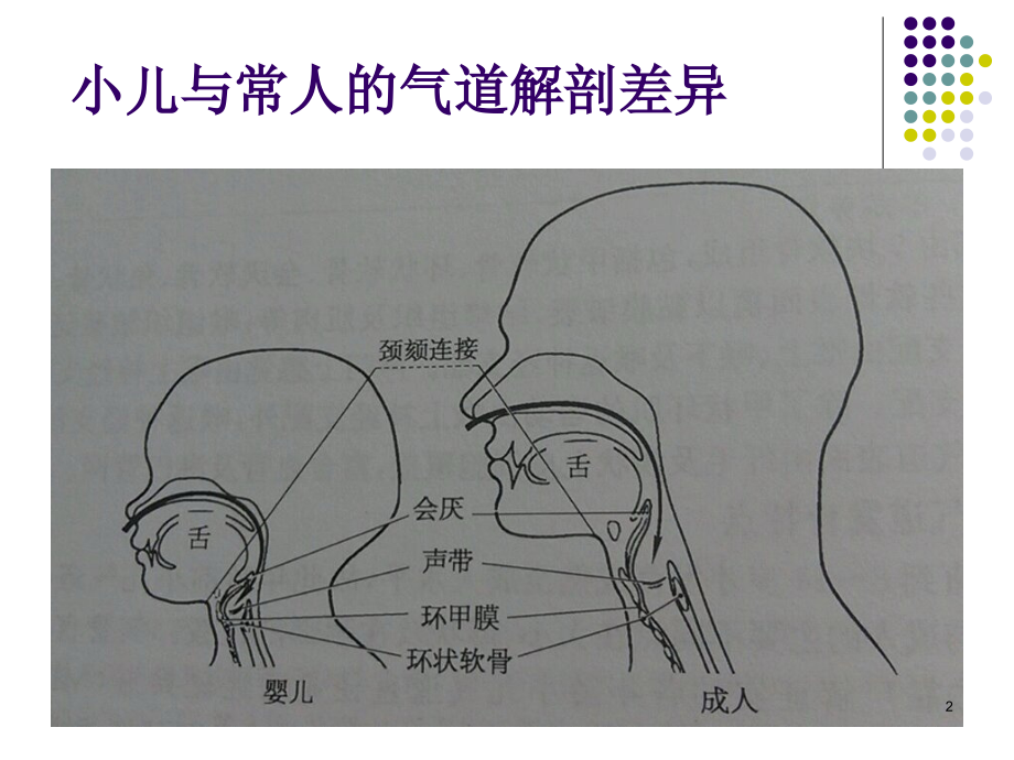 小儿高级气道管理.ppt_第2页