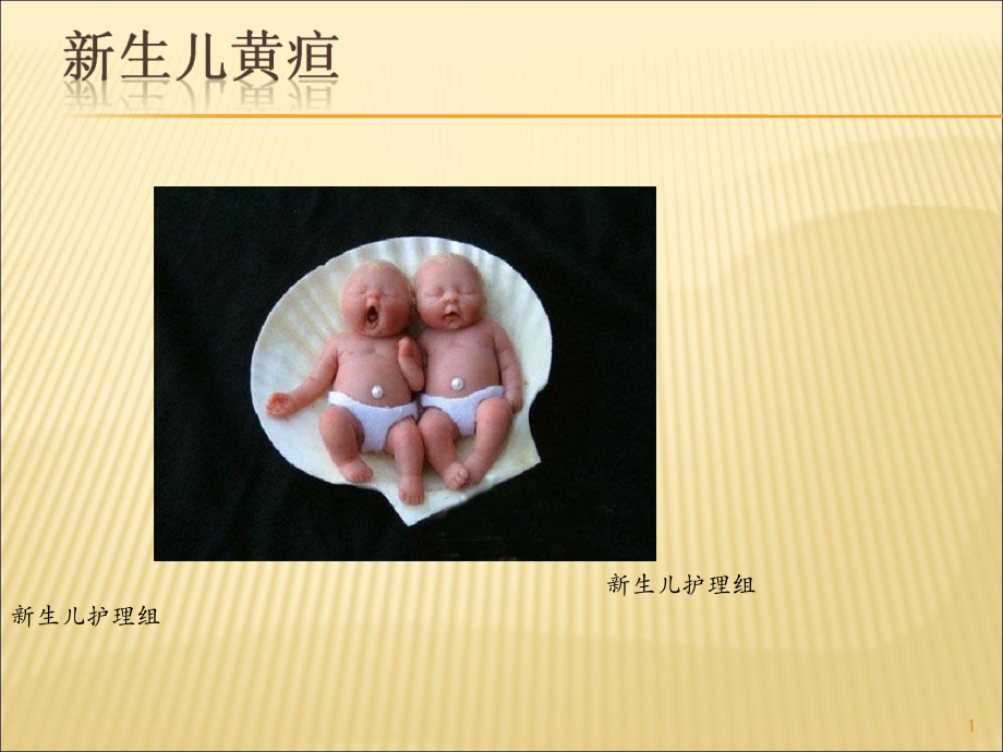 实习生带教新生儿黄疸.ppt_第1页