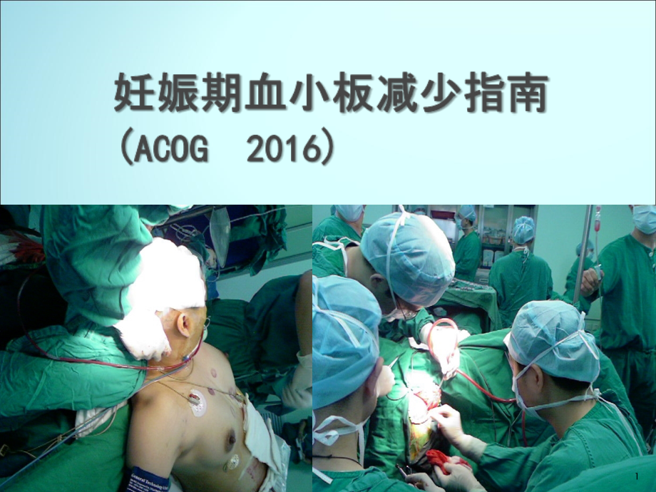 妊娠与血小板减少ppt课件.ppt_第1页