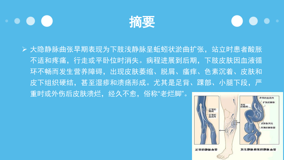 大隐静脉曲张培训教程.ppt_第2页
