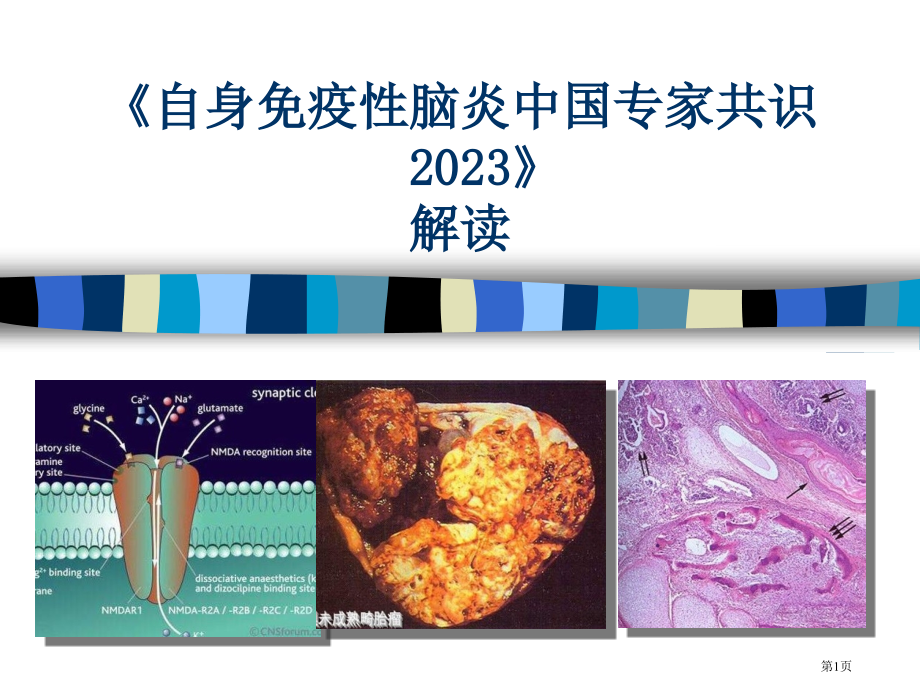 自身免疫性脑炎我国专家共识解读精华.pptx_第1页