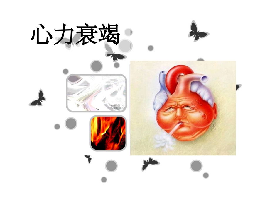 心力衰竭患者的护理完整.ppt_第1页