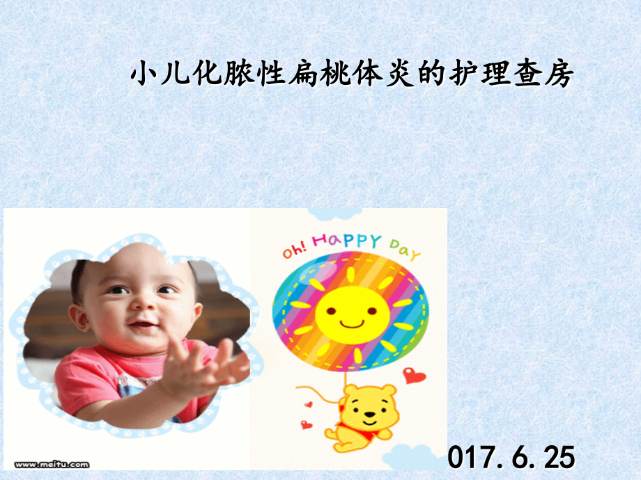 小儿化脓性扁桃体炎课件.ppt_第1页