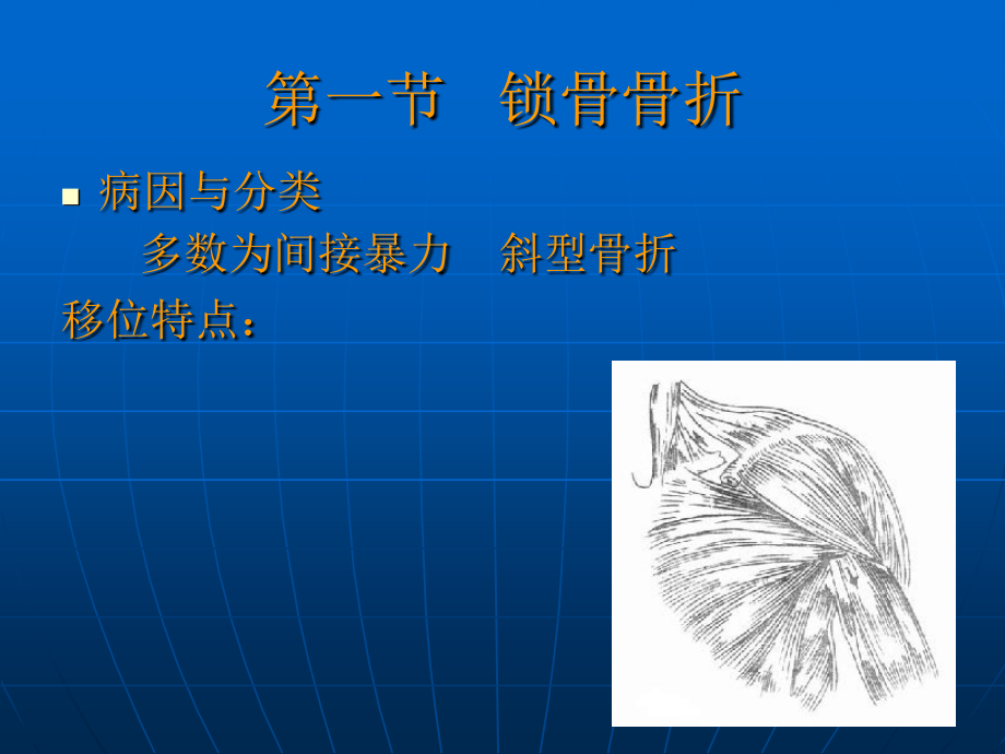 上肢骨关节损伤ppt医学课件.ppt_第2页