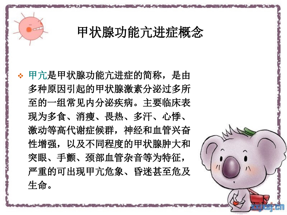 甲亢护理医学PPT课件.ppt_第2页