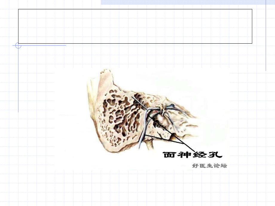 面神经麻痹的护理PPT课件.ppt_第2页