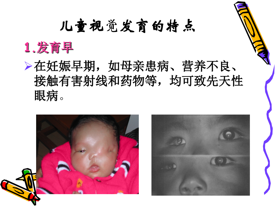 近视眼的防控演示课件.ppt_第2页