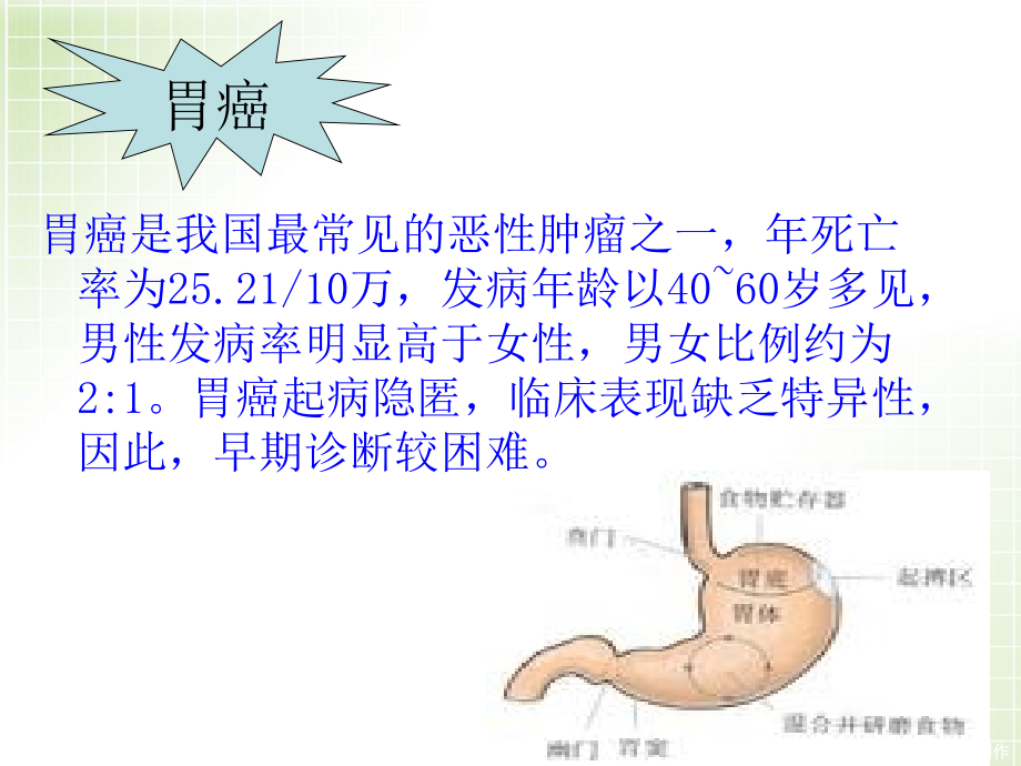 胃癌病人护理查房的ppt.ppt_第2页