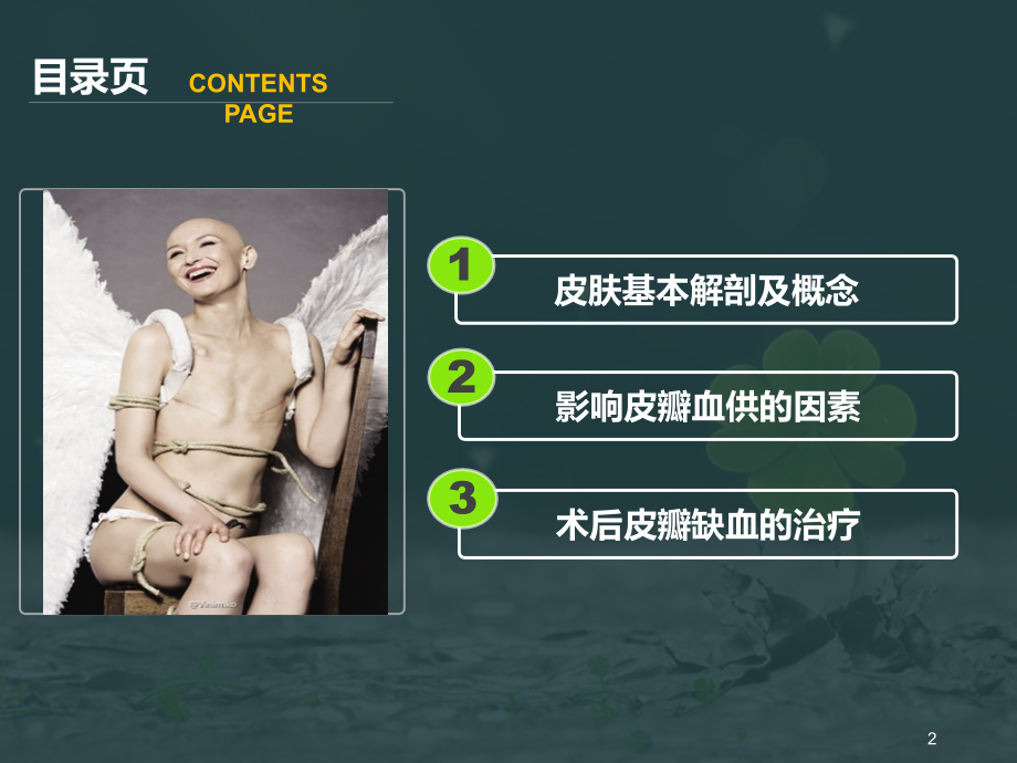乳腺癌手术皮瓣的相关处理.pptx_第2页