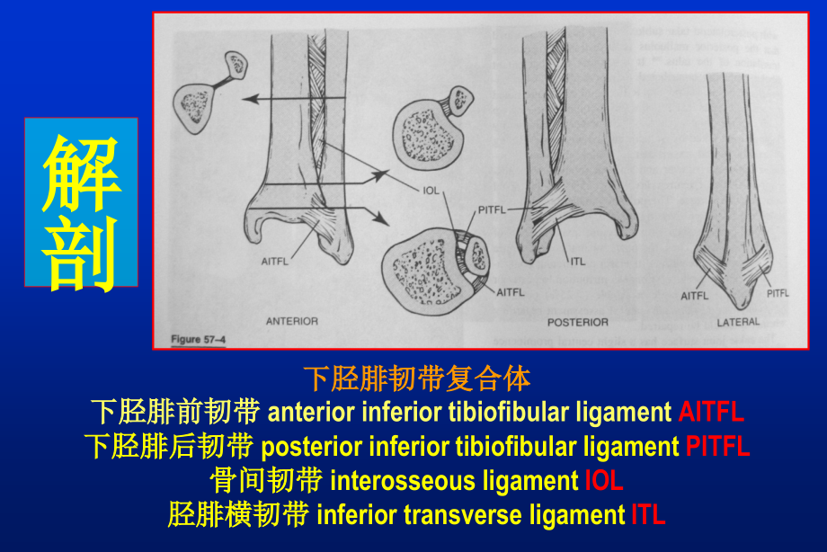 下胫腓联合损伤的诊治.ppt_第2页