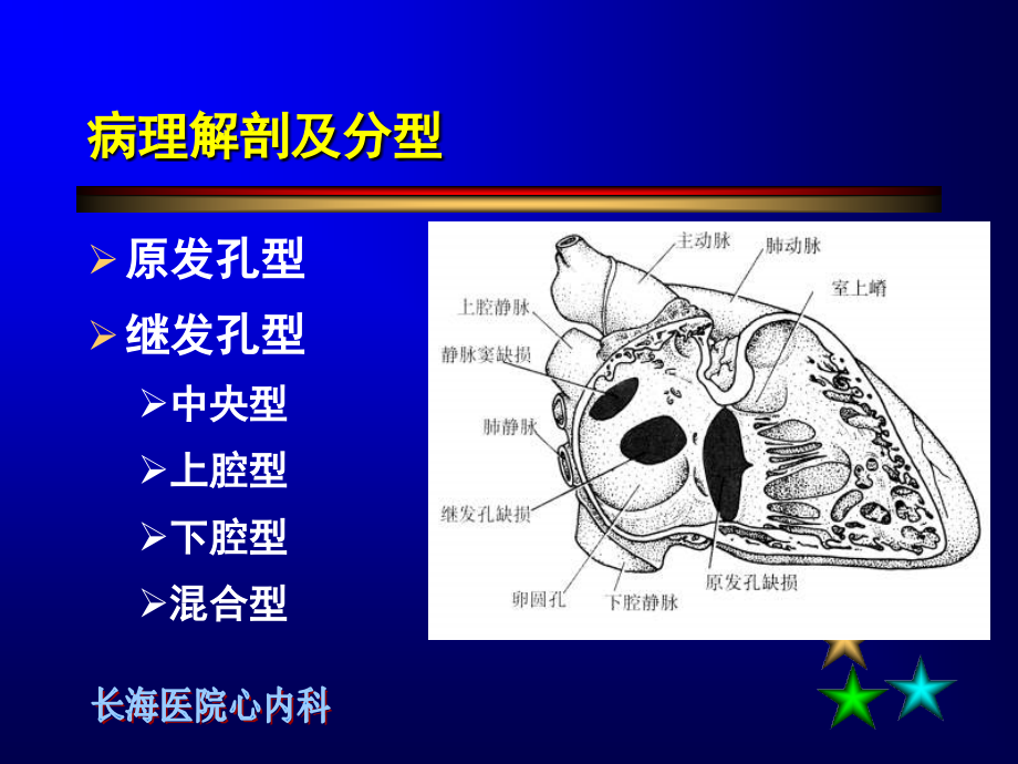 (ppt)房间隔缺损介入治疗.ppt_第2页
