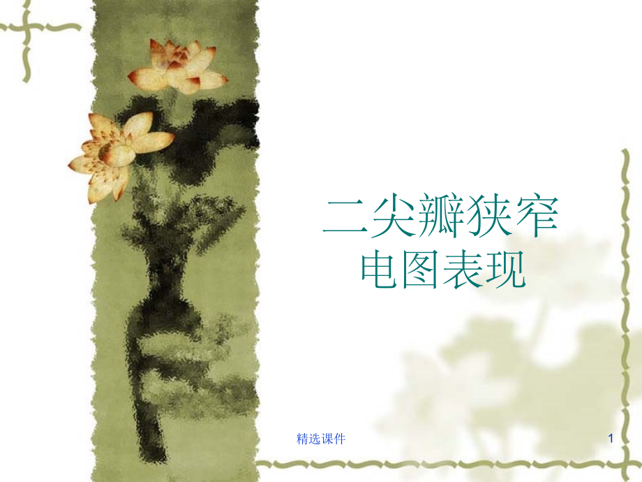 二尖瓣狭窄心电图表现.ppt_第1页