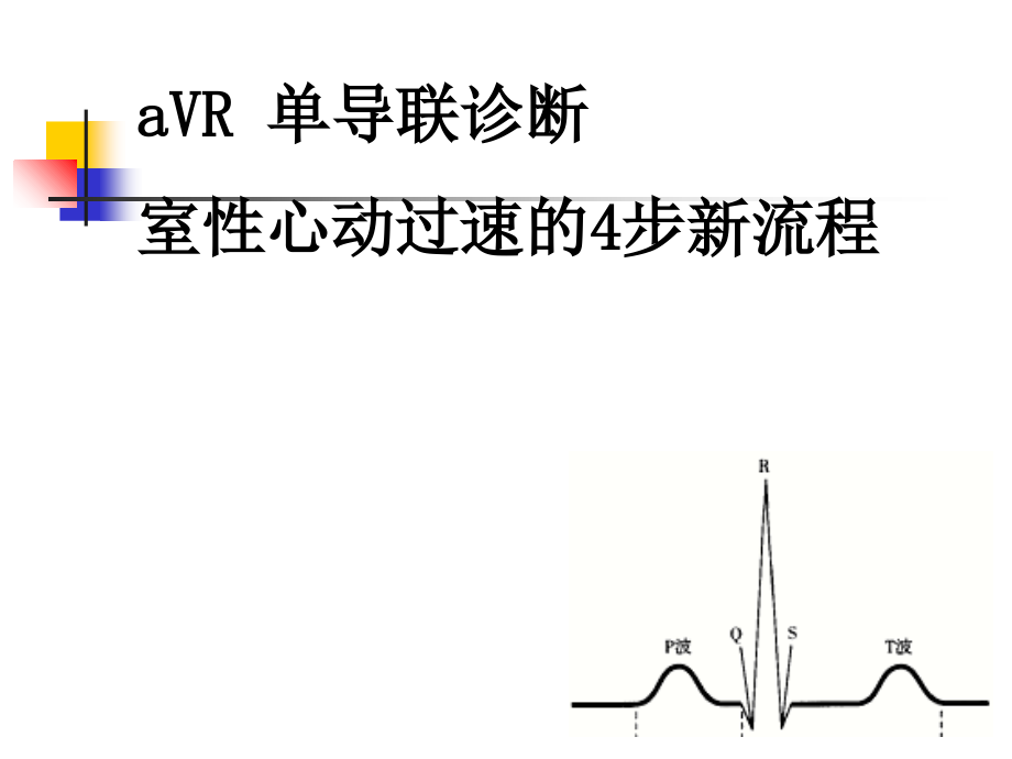 AVR单导联诊断室性心动过速.ppt_第1页