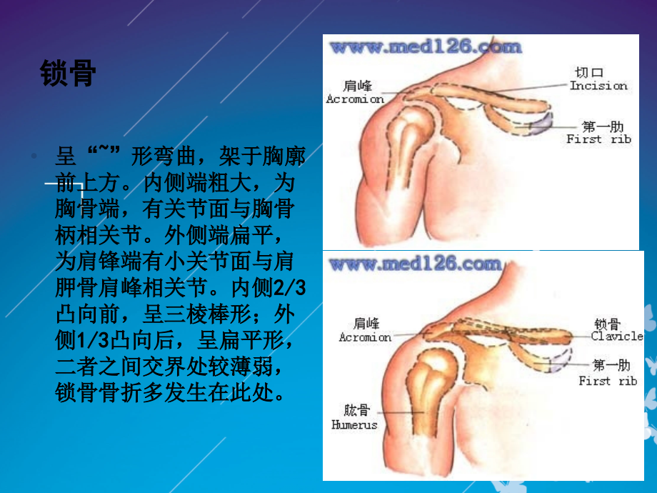 锁骨骨折切开内固定除术护理查房.pptx_第2页