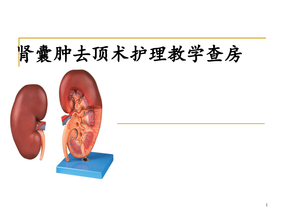 肾囊肿去顶术护理.ppt_第1页