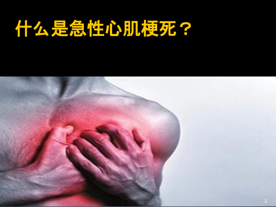 急性心肌梗死的溶栓治疗PPT课件.ppt_第2页