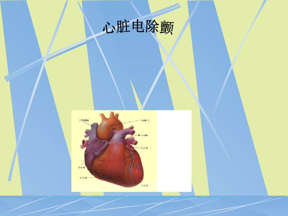 2022年医学专题-心脏电除颤术.ppt_第1页