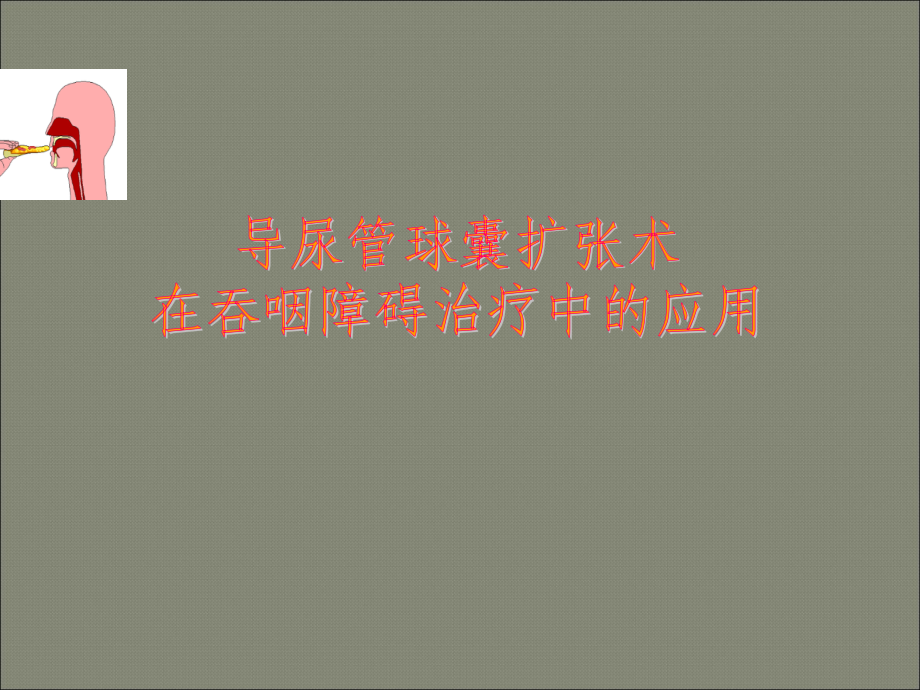 导尿管球囊扩张术在吞咽障碍治疗中应用PPT课件.ppt_第1页