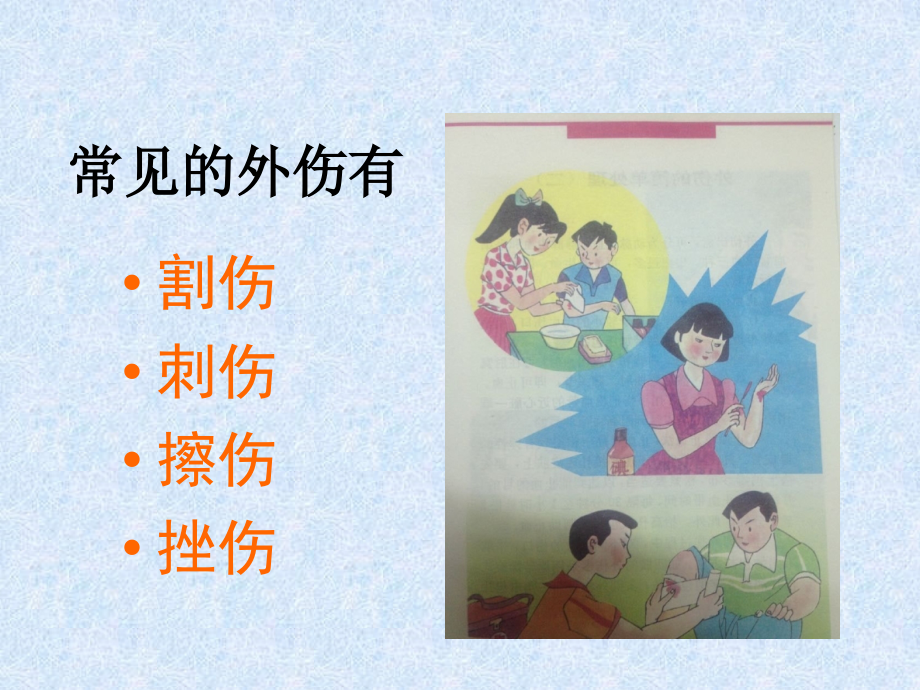 外伤的简单处理（一）.ppt_第2页
