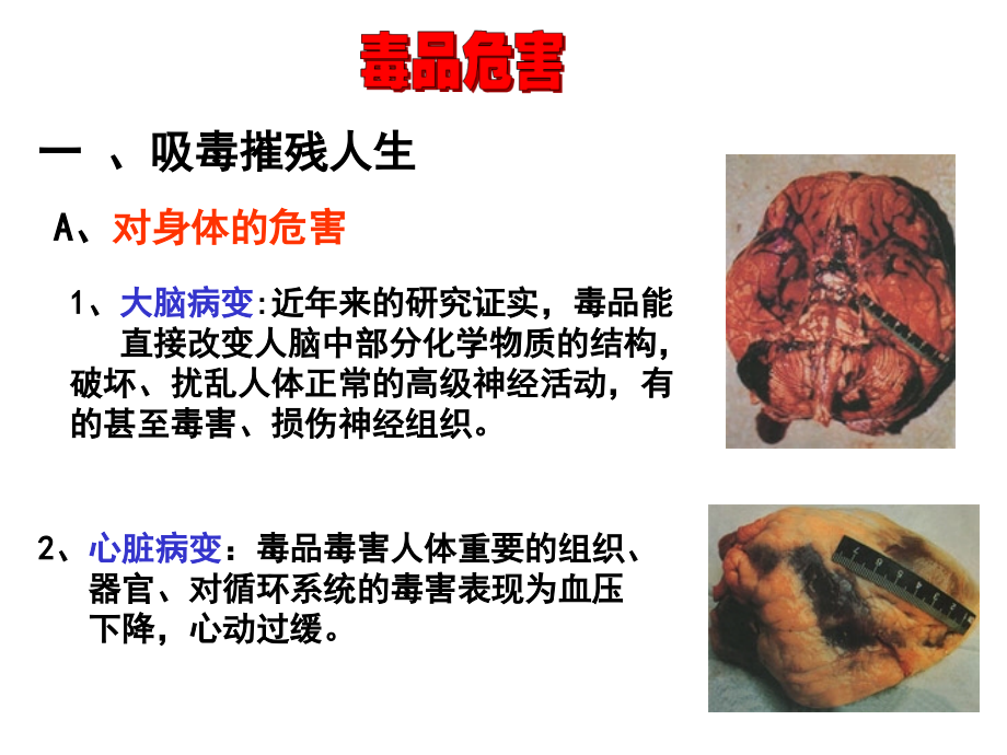 班会课课件：珍爱生命_远离毒品.ppt_第2页