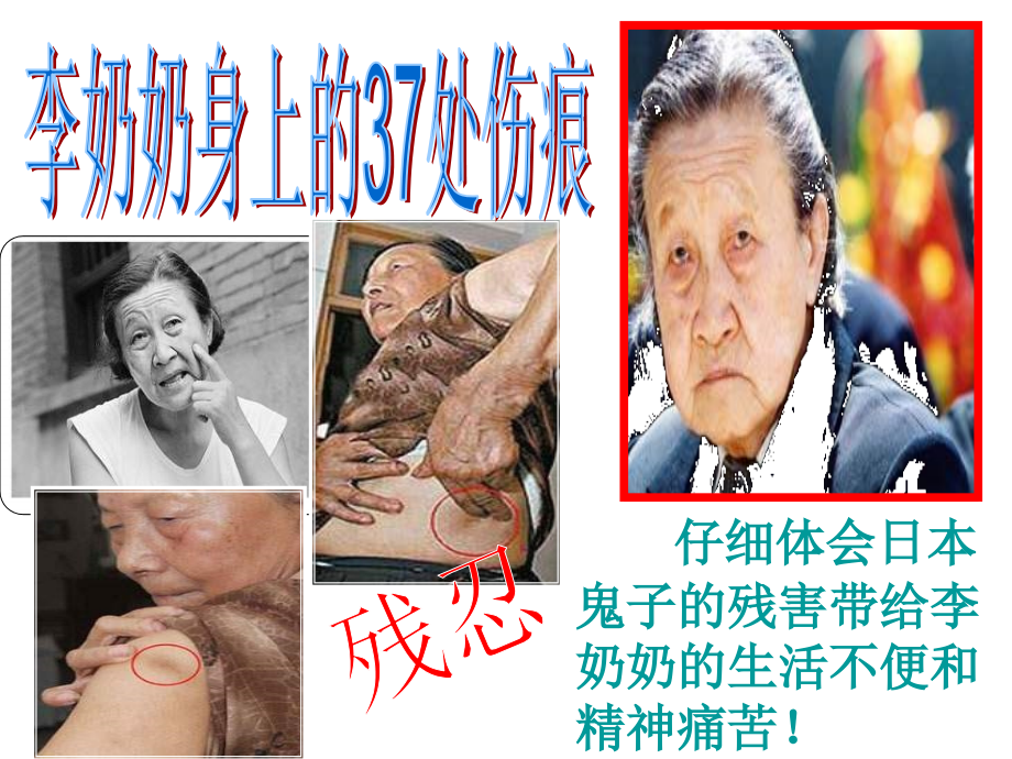 李奶奶身上的伤痕.ppt_第2页