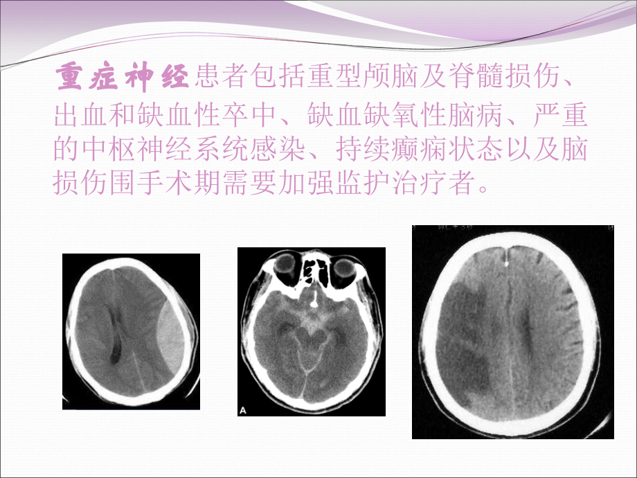 医学重症神经患者的镇静.ppt_第2页