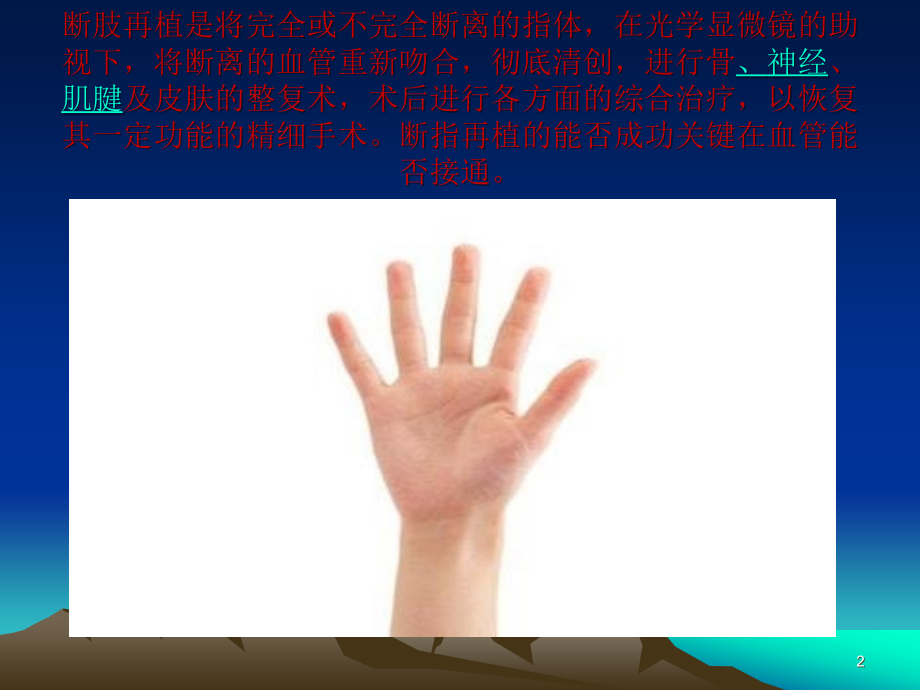 断指再植术ppt课件.ppt_第2页
