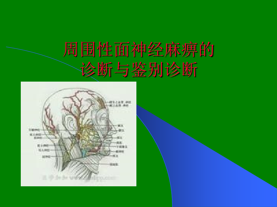 面神经麻痹的诊断与鉴别诊断.ppt_第1页